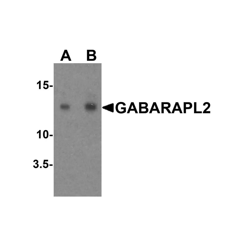 ProSci 7895 GABARAPL2 Antibody, ProSci, 0.1 mg/Unit Primary Image