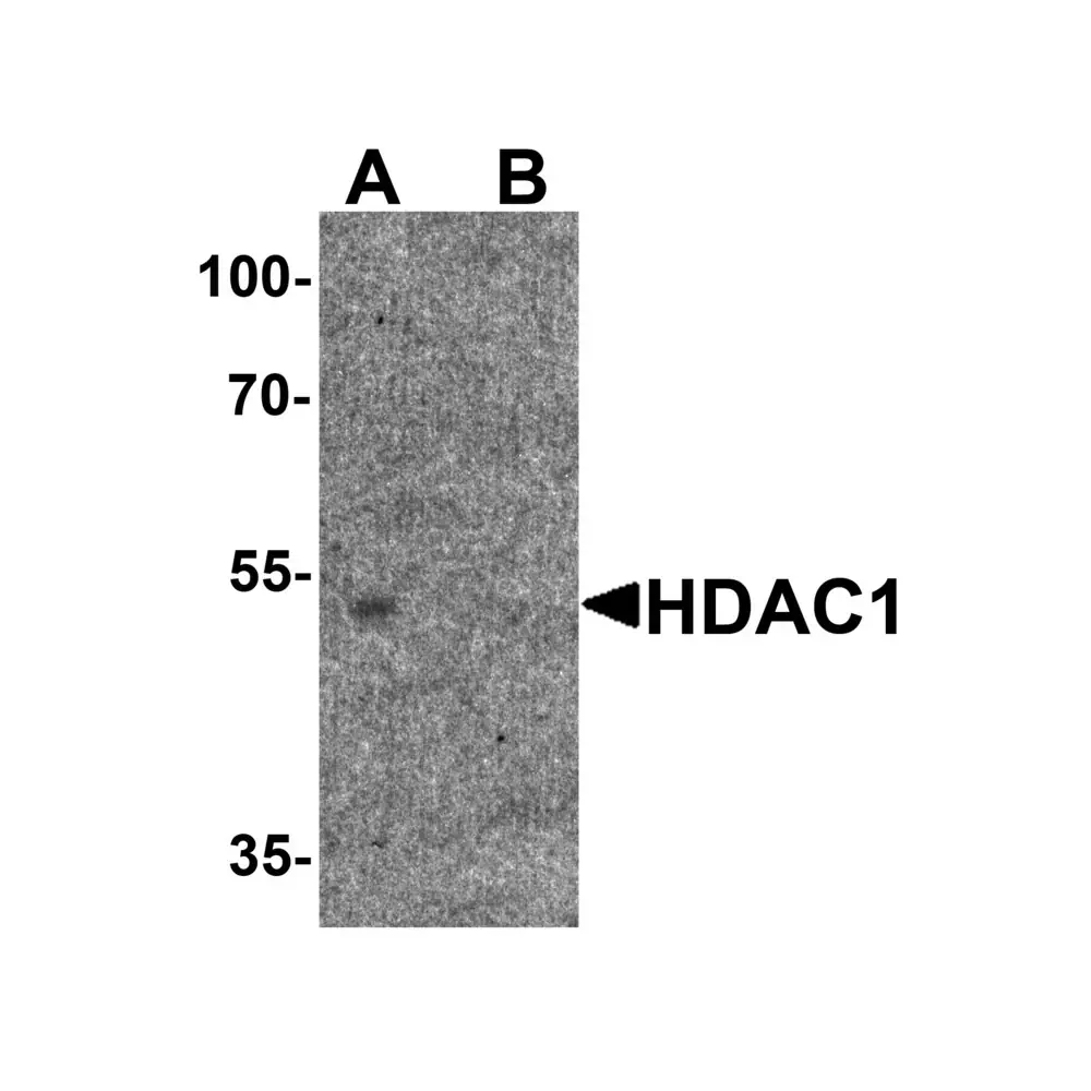 ProSci 7897_S HDAC1 Antibody, ProSci, 0.02 mg/Unit Primary Image