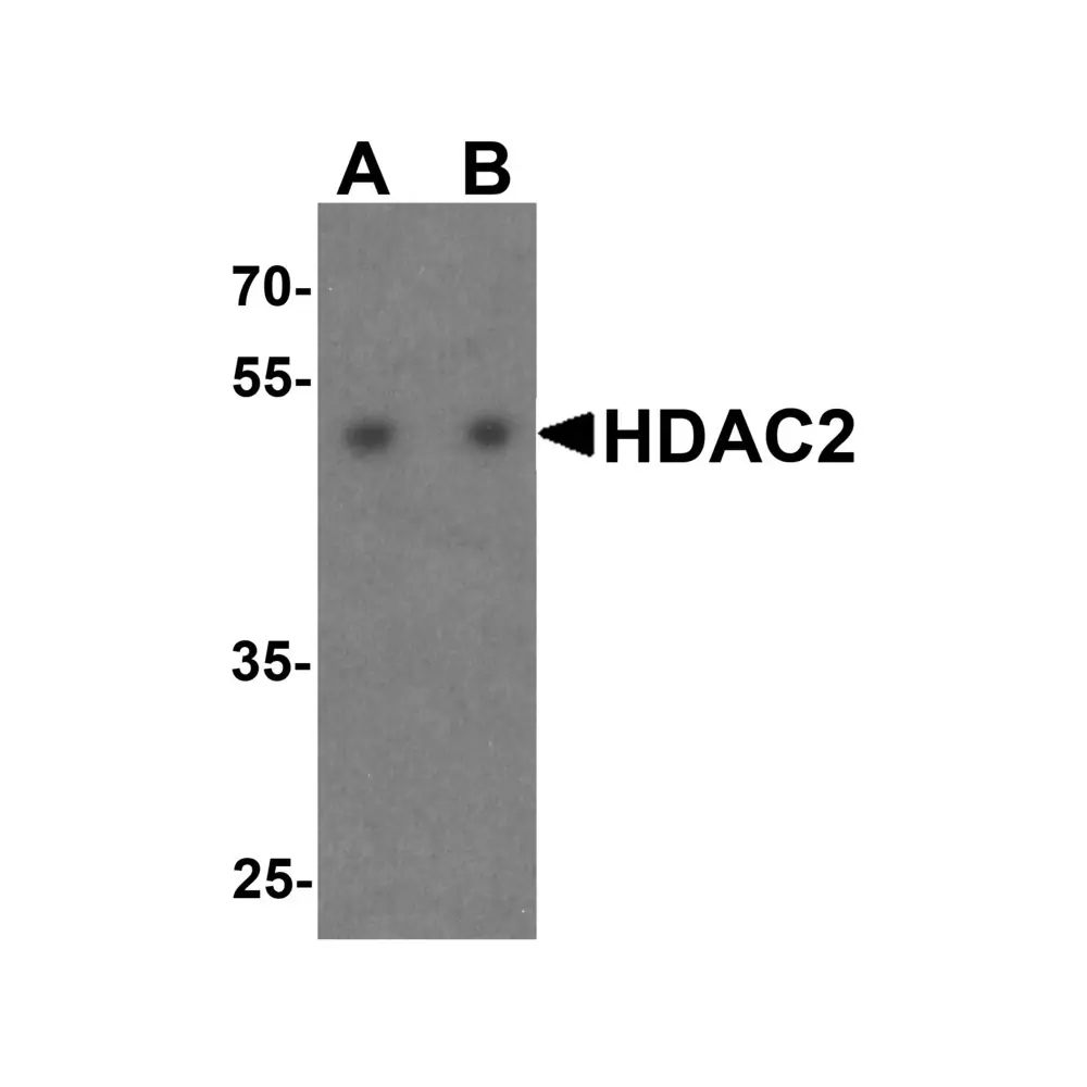 ProSci 7899 HDAC2 Antibody, ProSci, 0.1 mg/Unit Primary Image