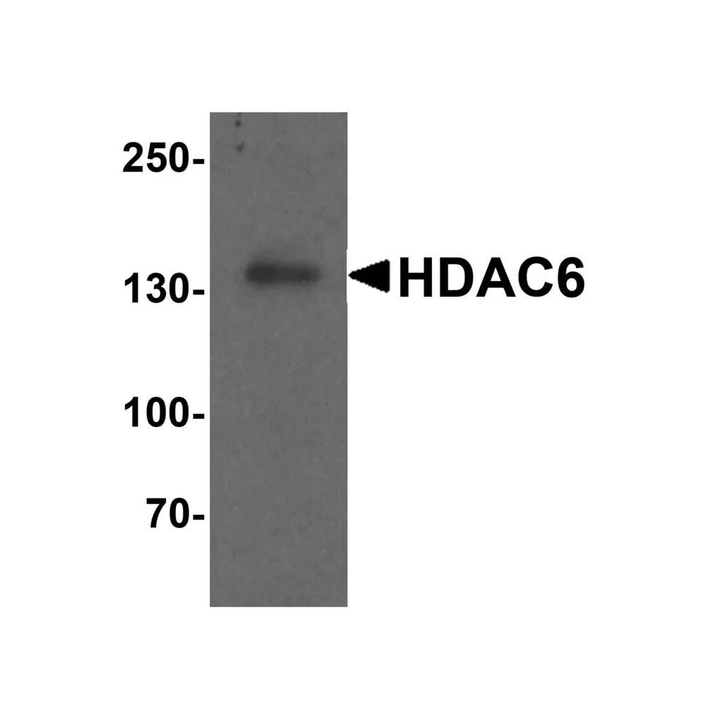 ProSci 7901_S HDAC6 Antibody, ProSci, 0.02 mg/Unit Primary Image