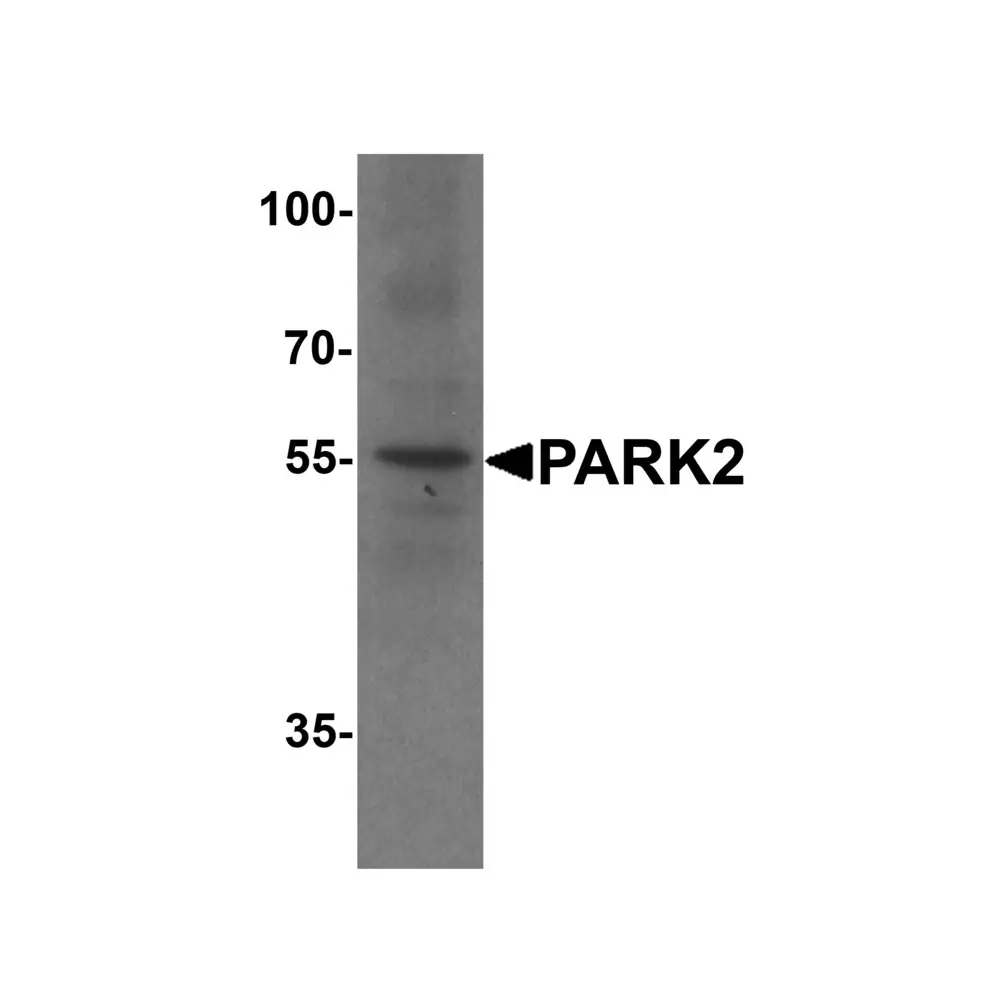 ProSci 7903 PARK2 Antibody, ProSci, 0.1 mg/Unit Primary Image
