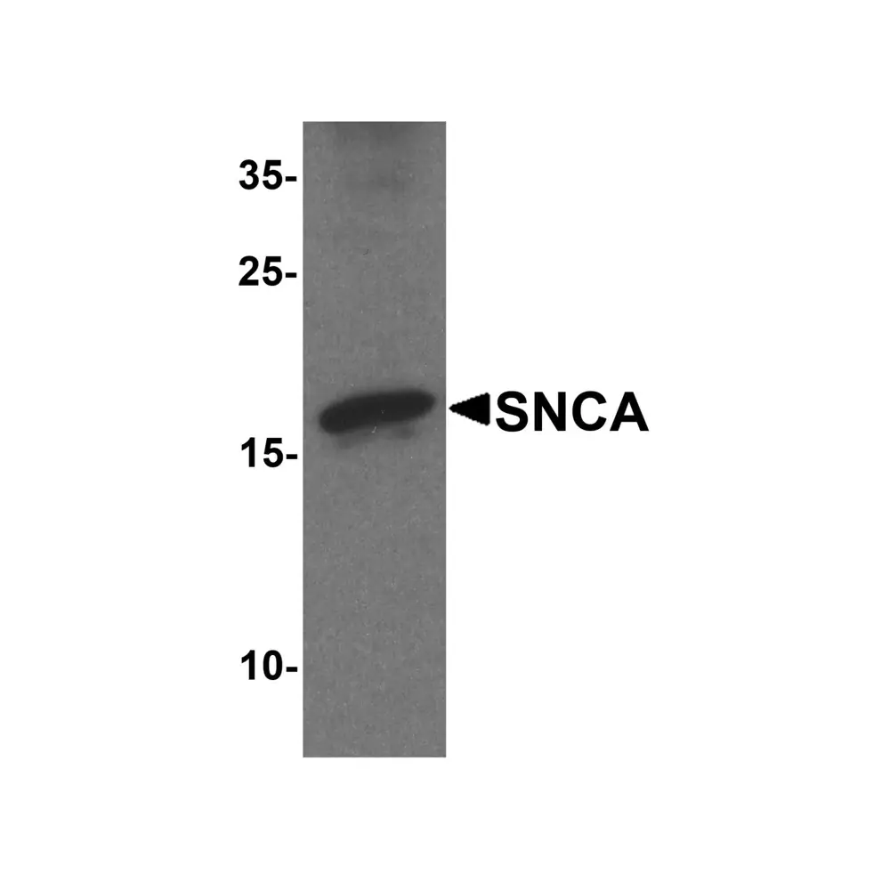 ProSci 7911 SNCA Antibody, ProSci, 0.1 mg/Unit Primary Image