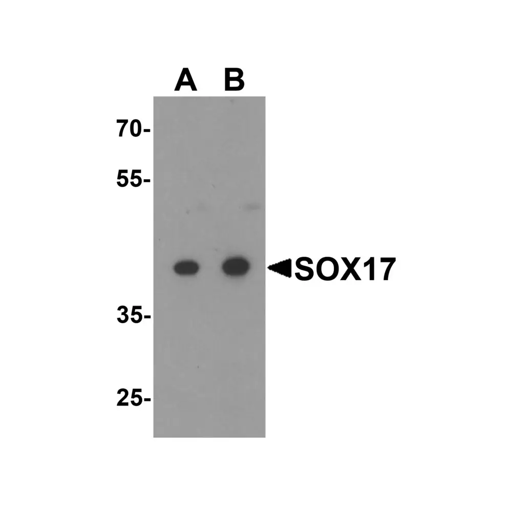 ProSci 7917 SOX17 Antibody, ProSci, 0.1 mg/Unit Primary Image