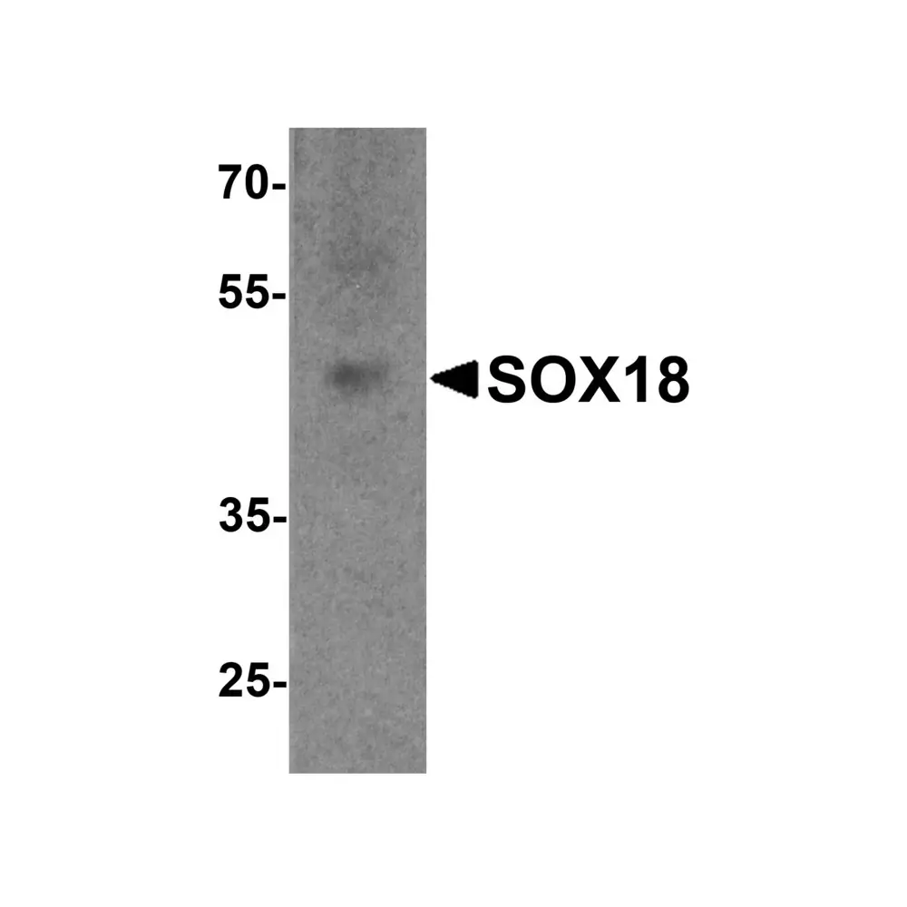 ProSci 7919 SOX18 Antibody, ProSci, 0.1 mg/Unit Primary Image