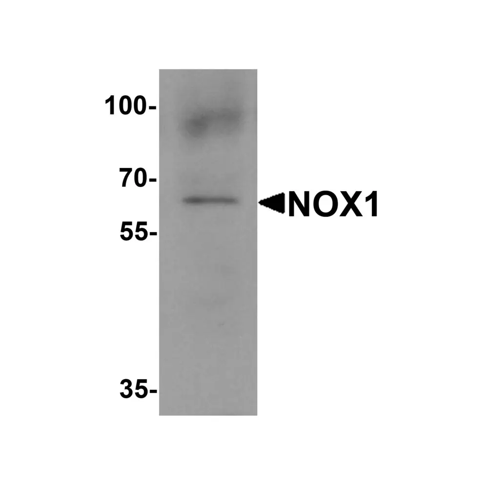 ProSci 7921 NOX1 Antibody, ProSci, 0.1 mg/Unit Primary Image