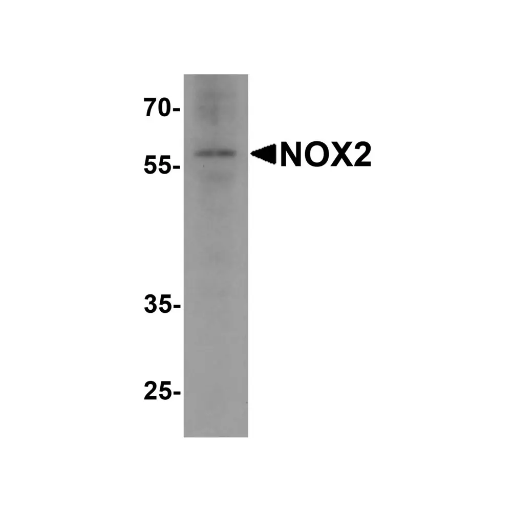 ProSci 7923 NOX2 Antibody, ProSci, 0.1 mg/Unit Primary Image