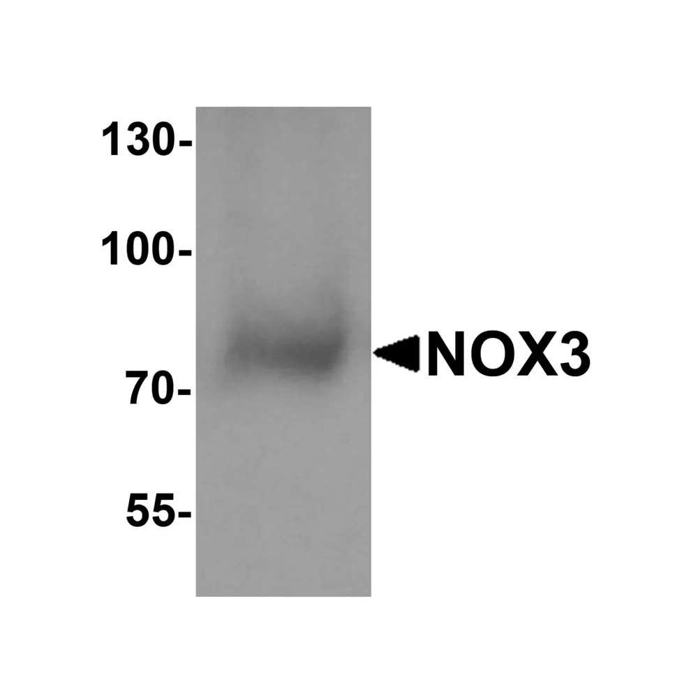 ProSci 7925 NOX3 Antibody, ProSci, 0.1 mg/Unit Primary Image
