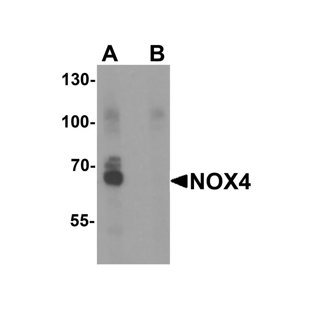 ProSci 7927 NOX4 Antibody, ProSci, 0.1 mg/Unit Primary Image