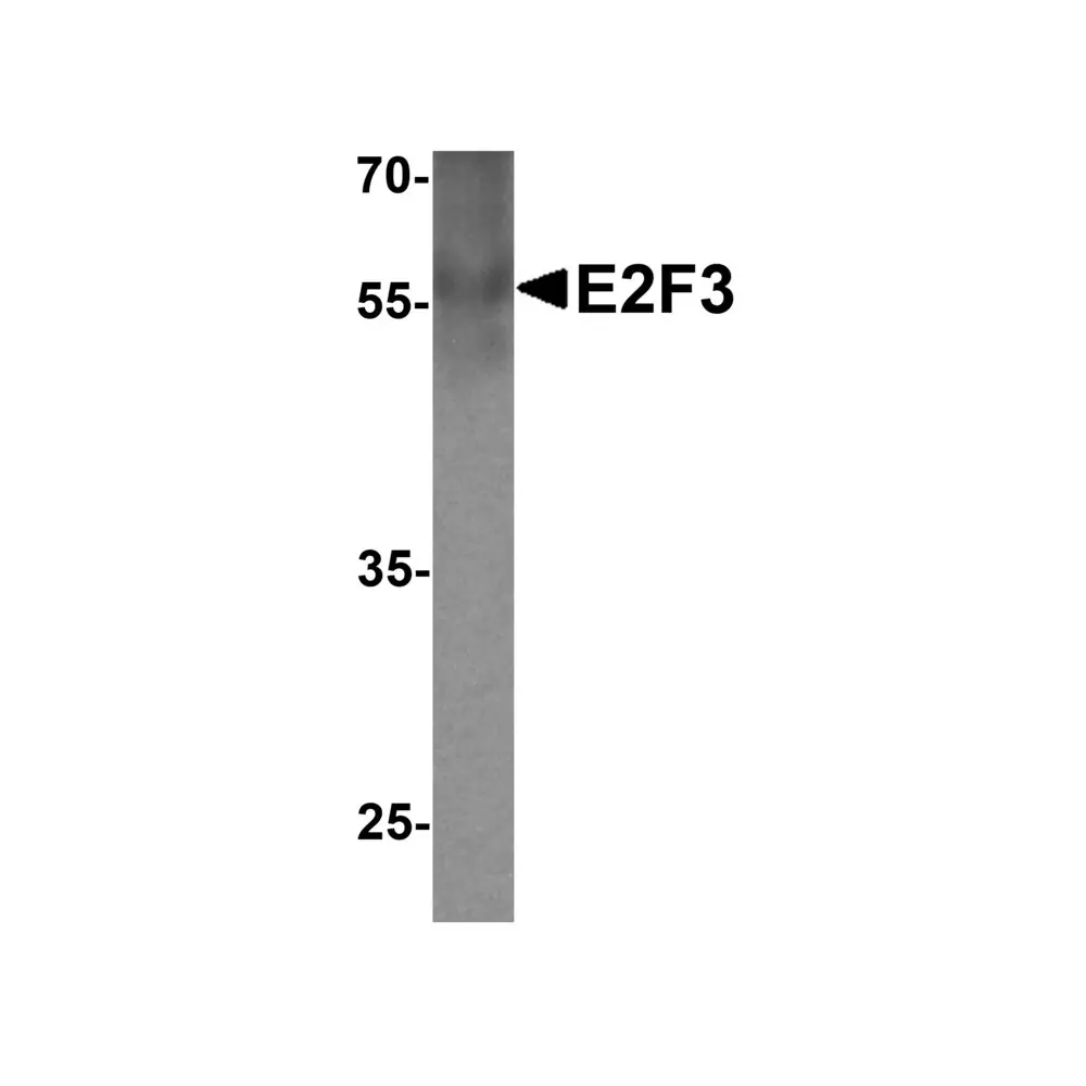 ProSci 7929 E2F3 Antibody, ProSci, 0.1 mg/Unit Primary Image