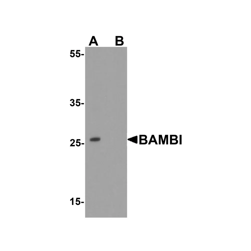 ProSci 7931_S BAMBI Antibody, ProSci, 0.02 mg/Unit Primary Image