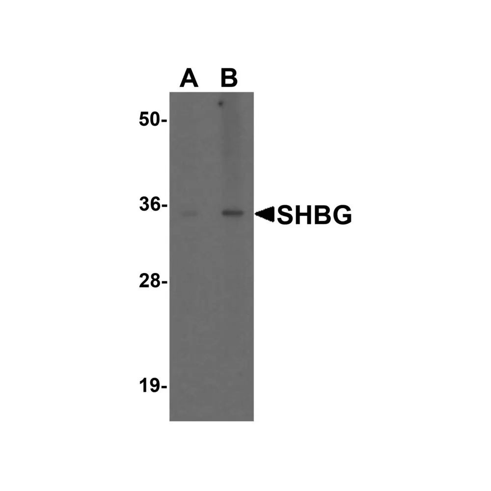 ProSci 7935 SHBG Antibody, ProSci, 0.1 mg/Unit Primary Image