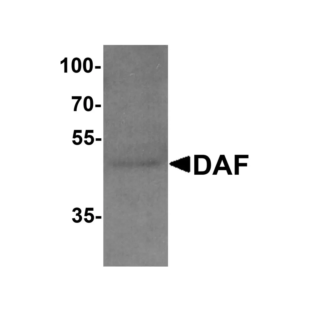 ProSci 7937_S DAF Antibody, ProSci, 0.02 mg/Unit Primary Image