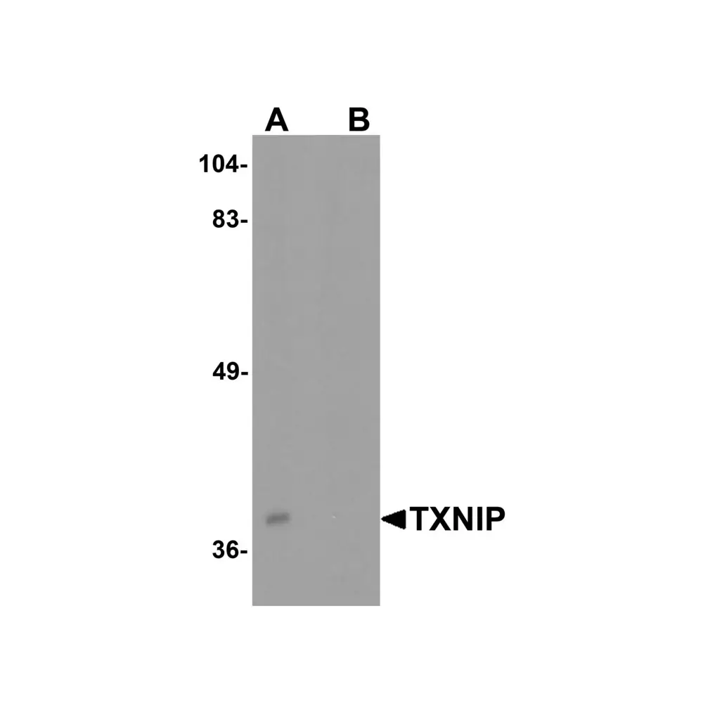 ProSci 7941 TXNIP Antibody, ProSci, 0.1 mg/Unit Primary Image