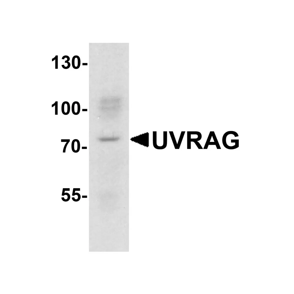 ProSci 7947 UVRAG Antibody, ProSci, 0.1 mg/Unit Primary Image