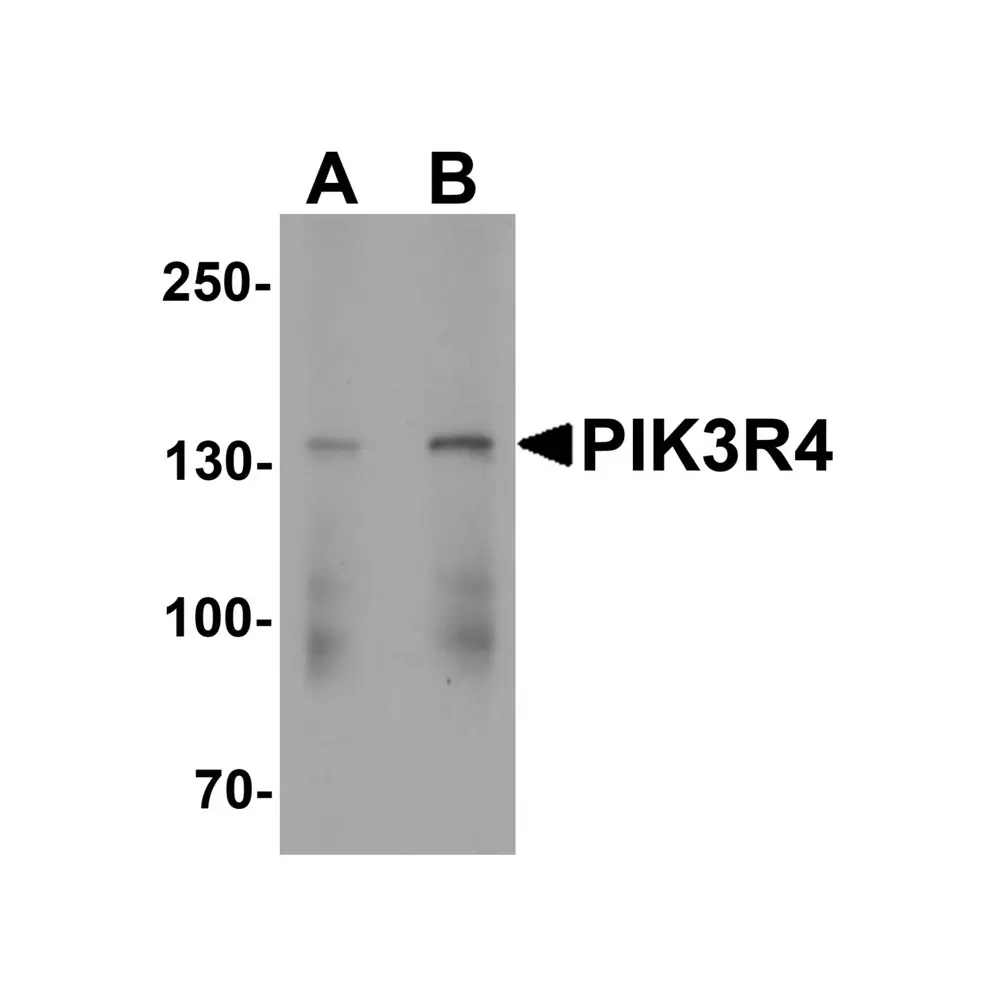 ProSci 7949 PIK3R4 Antibody, ProSci, 0.1 mg/Unit Primary Image