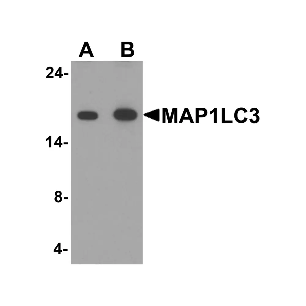 ProSci 7951_S MAP1LC3 Antibody, ProSci, 0.02 mg/Unit Primary Image