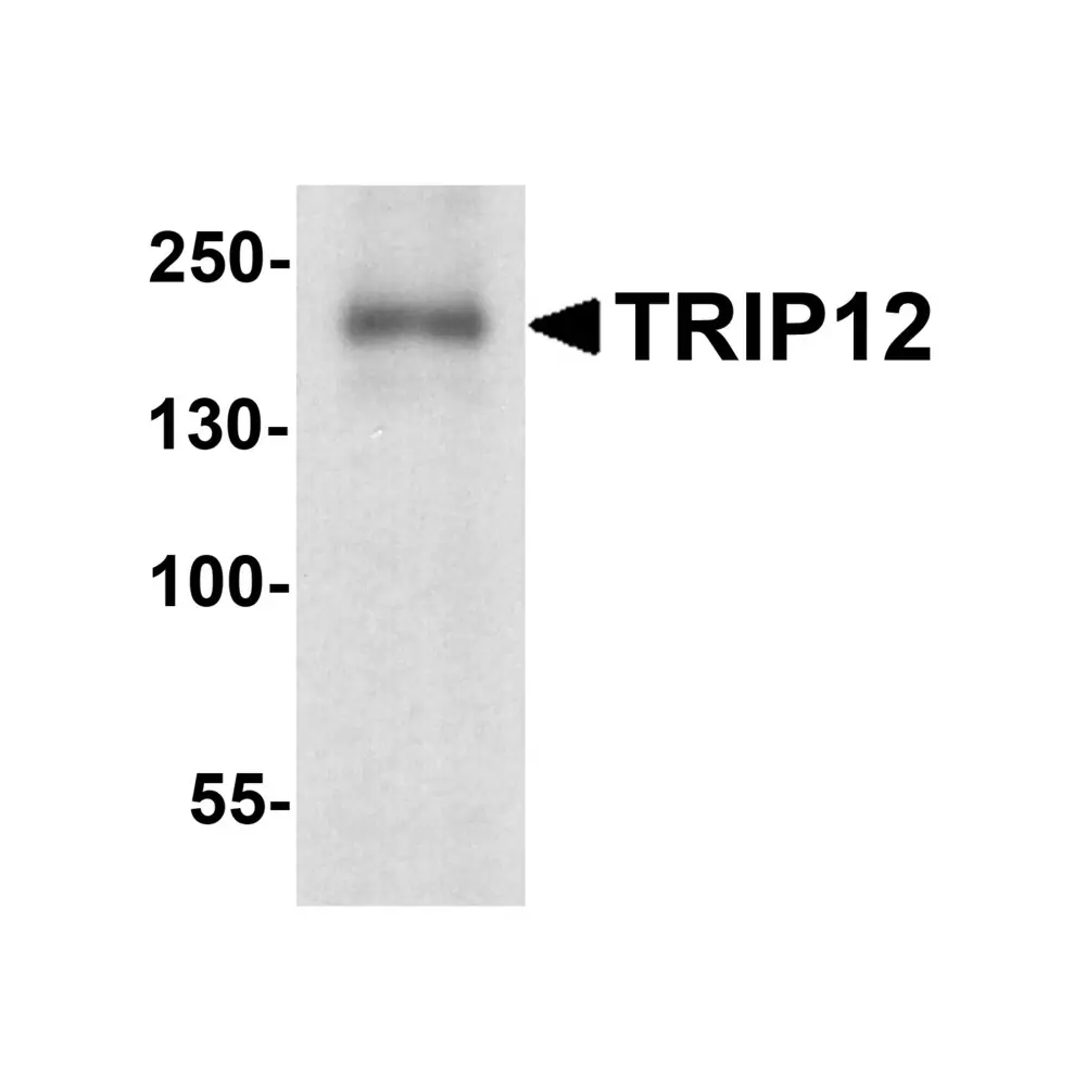 ProSci 7953 TRIP12 Antibody, ProSci, 0.1 mg/Unit Primary Image