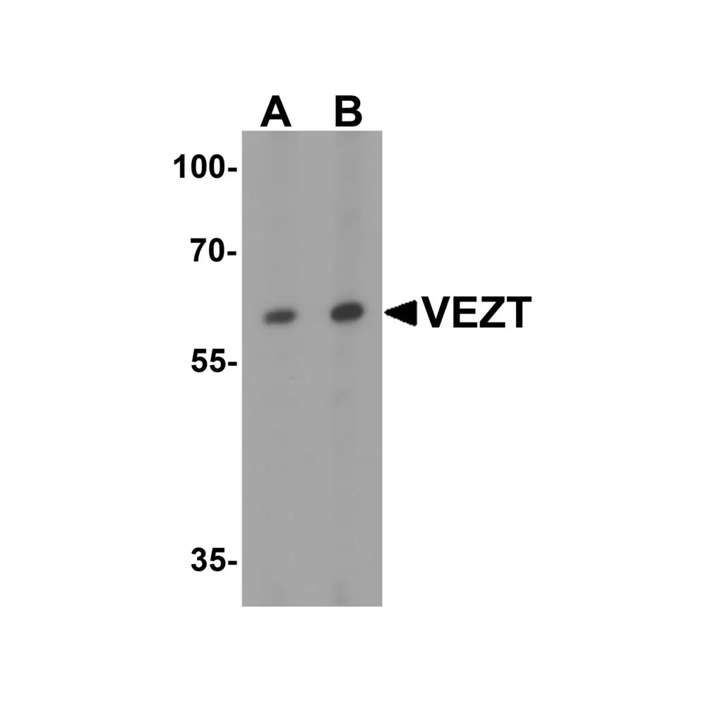 ProSci 7959 VEZT Antibody, ProSci, 0.1 mg/Unit Primary Image