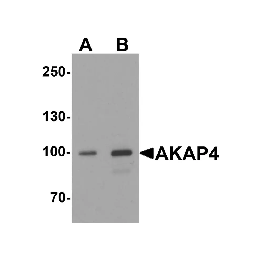 ProSci 7961_S AKAP4 Antibody, ProSci, 0.02 mg/Unit Primary Image