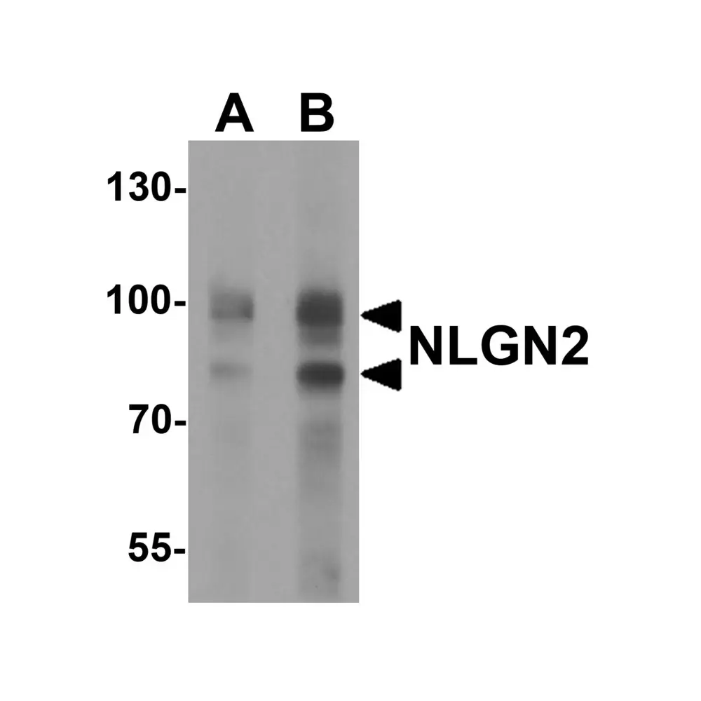 ProSci 7969 NLGN2 Antibody, ProSci, 0.1 mg/Unit Primary Image