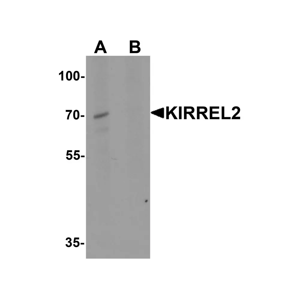 ProSci 7971 KIRREL2 Antibody, ProSci, 0.1 mg/Unit Primary Image
