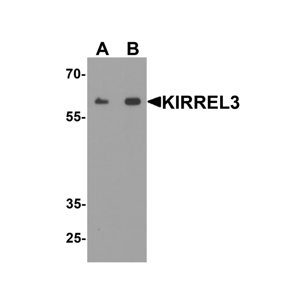 ProSci 7973 KIRREL3 Antibody, ProSci, 0.1 mg/Unit Primary Image