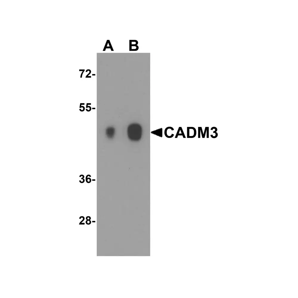 ProSci 7975_S CADM3 Antibody, ProSci, 0.02 mg/Unit Primary Image