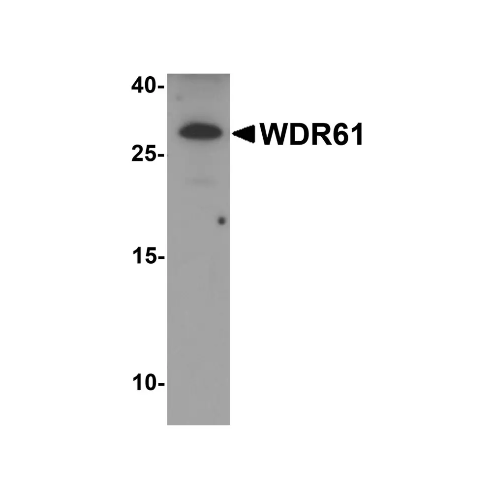 ProSci 7985_S WDR61 Antibody, ProSci, 0.02 mg/Unit Primary Image