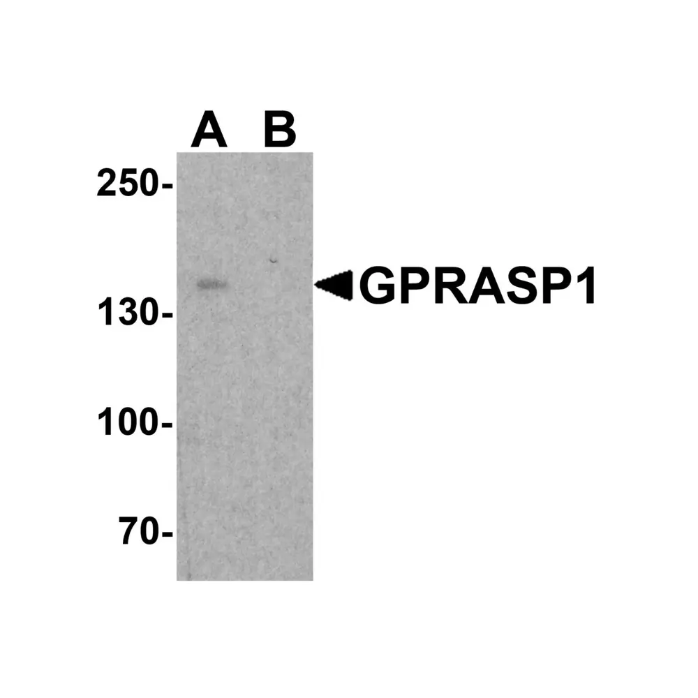 ProSci 7987 GPRASP1 Antibody, ProSci, 0.1 mg/Unit Primary Image
