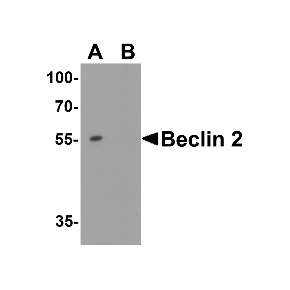 ProSci 7991 WWC1 Antibody, ProSci, 0.1 mg/Unit Primary Image
