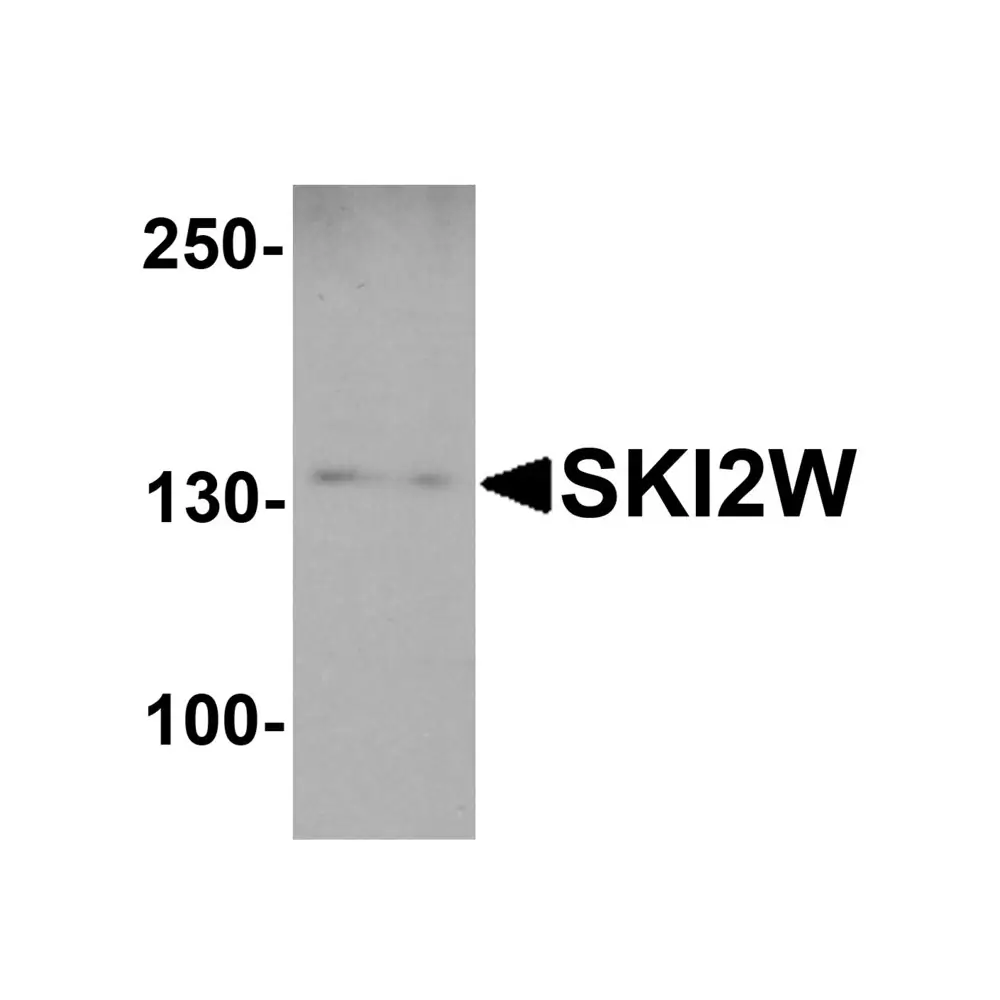 ProSci 7993 SKI2W Antibody, ProSci, 0.1 mg/Unit Primary Image