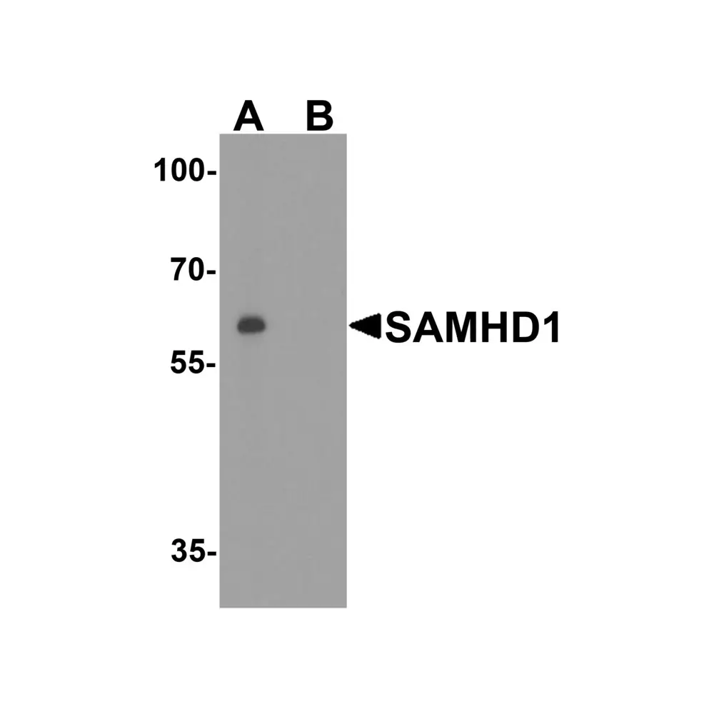 ProSci 8007_S SAMHD1 Antibody, ProSci, 0.02 mg/Unit Primary Image