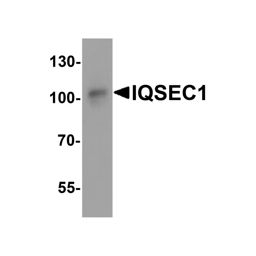 ProSci 8009_S IQSEC1 Antibody, ProSci, 0.02 mg/Unit Primary Image