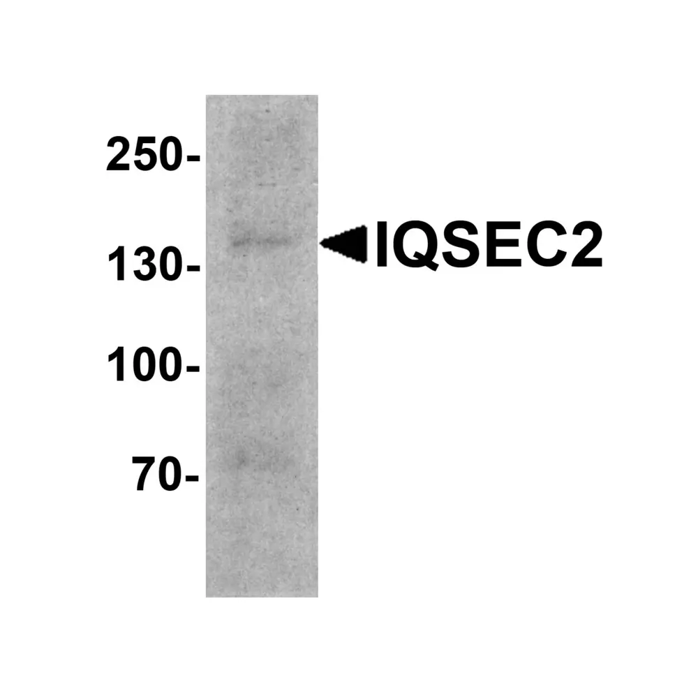 ProSci 8011_S IQSEC2 Antibody, ProSci, 0.02 mg/Unit Primary Image