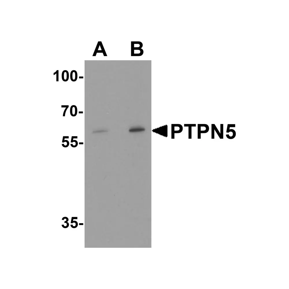 ProSci 8013_S PTPN5 Antibody, ProSci, 0.02 mg/Unit Primary Image