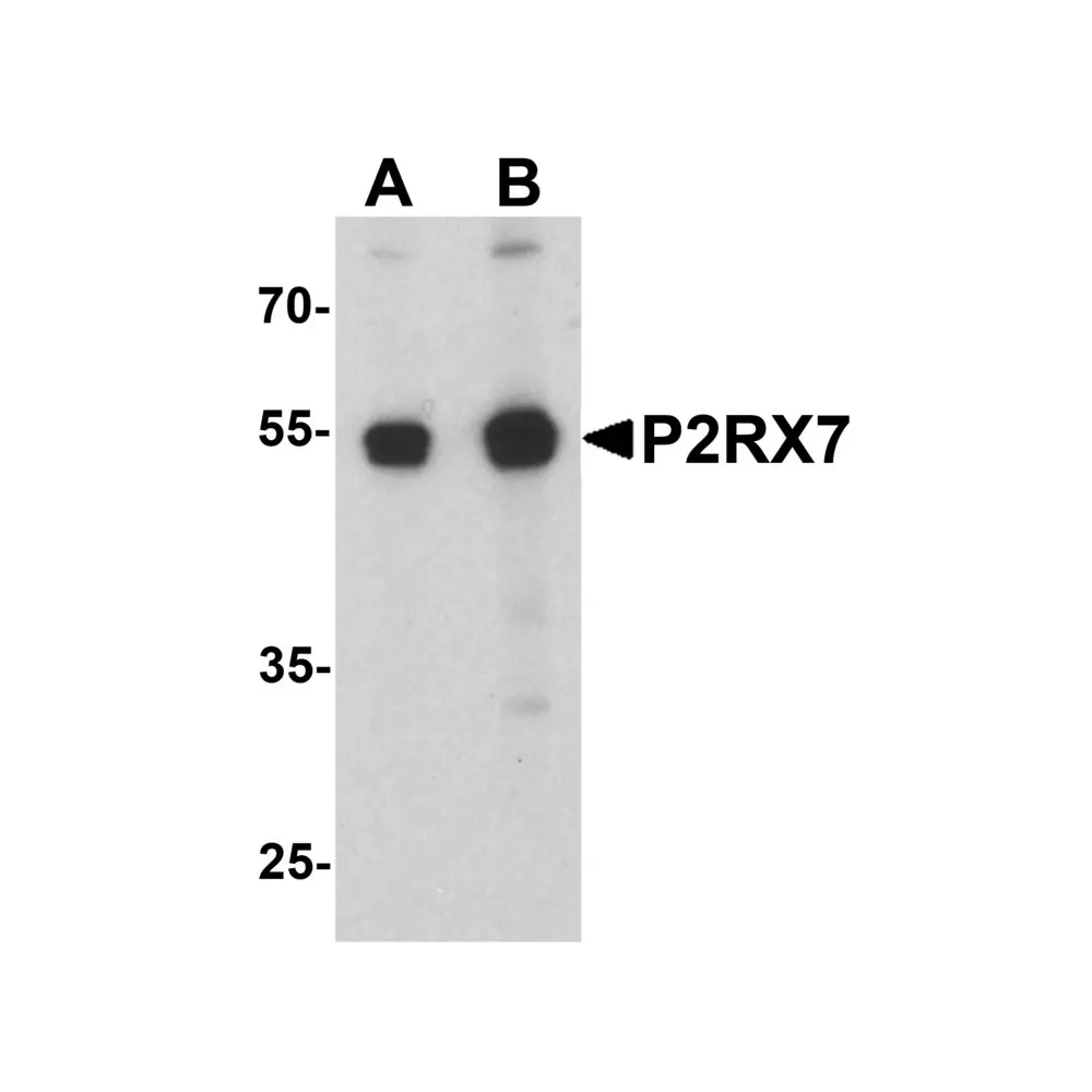 ProSci 8015 P2RX7 Antibody, ProSci, 0.1 mg/Unit Primary Image