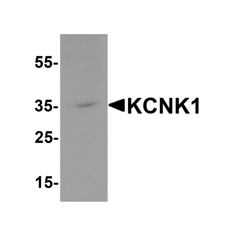 ProSci 8017 KCNK1 Antibody, ProSci, 0.1 mg/Unit Primary Image