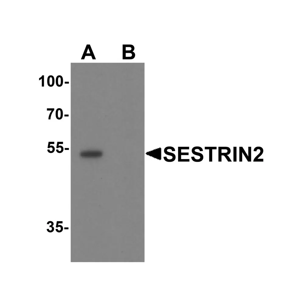 ProSci 8023 SESTRIN2 Antibody, ProSci, 0.1 mg/Unit Primary Image