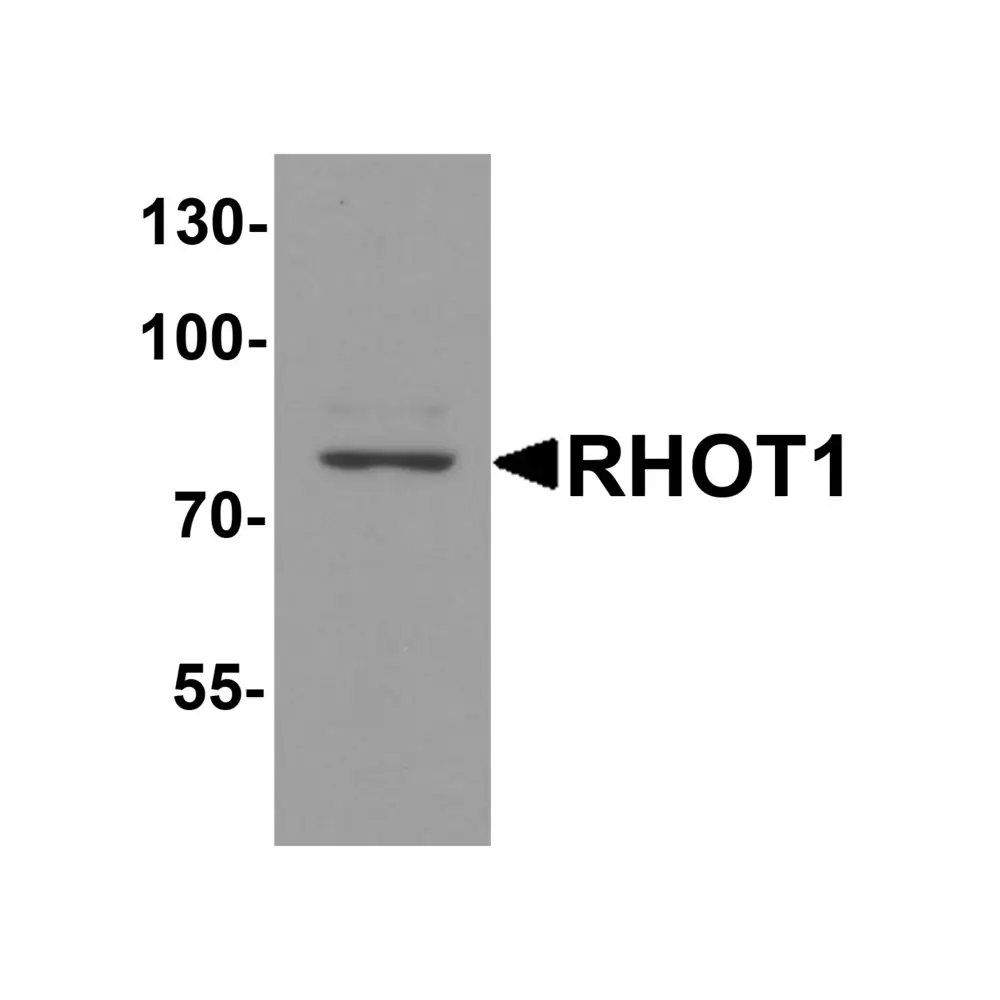 ProSci 8027_S RHOT1 Antibody, ProSci, 0.02 mg/Unit Primary Image