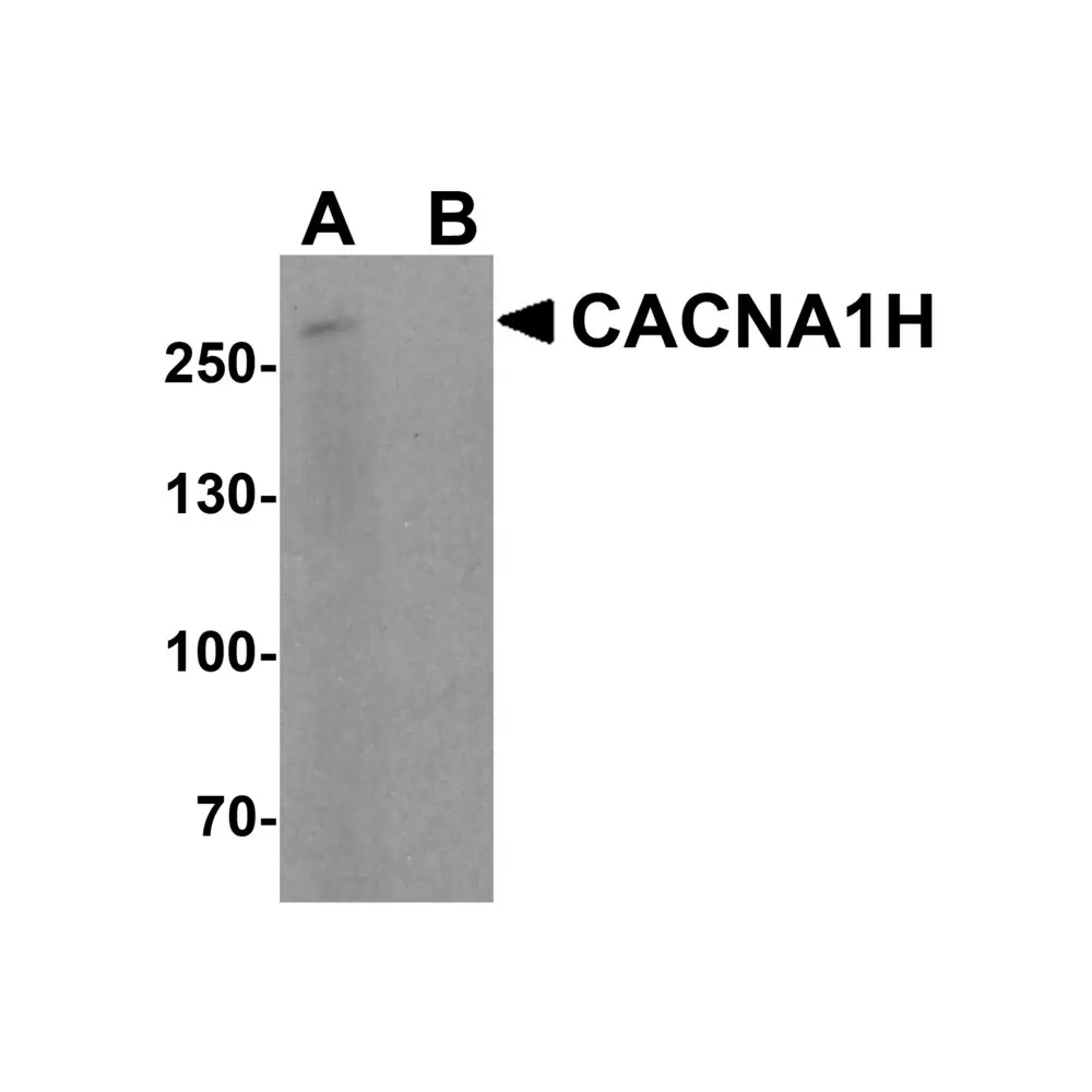 ProSci 8029 CACNA1H Antibody, ProSci, 0.1 mg/Unit Primary Image