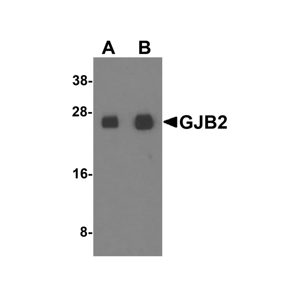 ProSci 8031 GJB2 Antibody, ProSci, 0.1 mg/Unit Primary Image