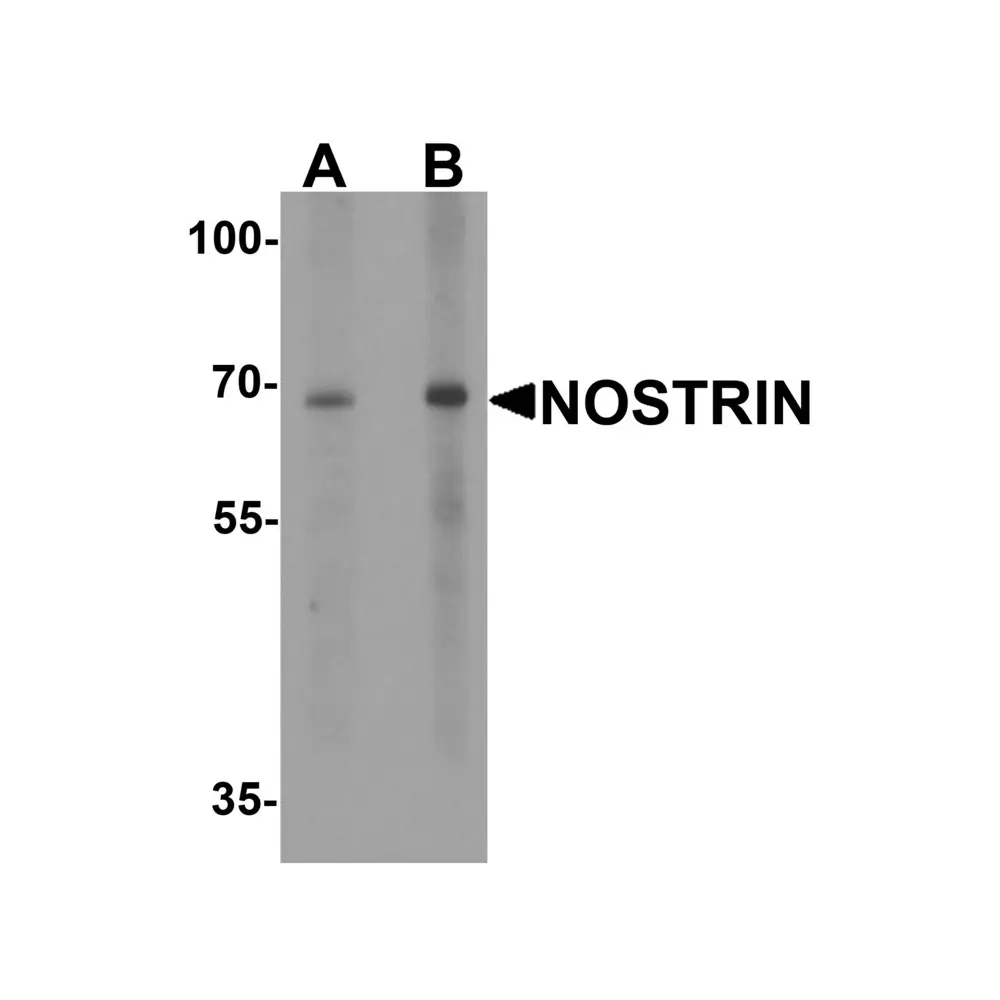 ProSci 8039 NOSTRIN Antibody, ProSci, 0.1 mg/Unit Primary Image