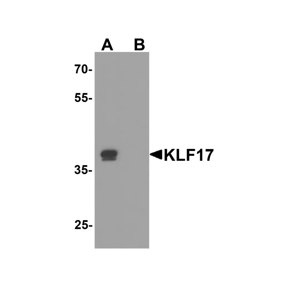 ProSci 8041 KLF17 Antibody, ProSci, 0.1 mg/Unit Primary Image