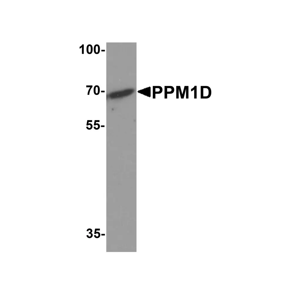 ProSci 8043 PPM1D Antibody, ProSci, 0.1 mg/Unit Primary Image