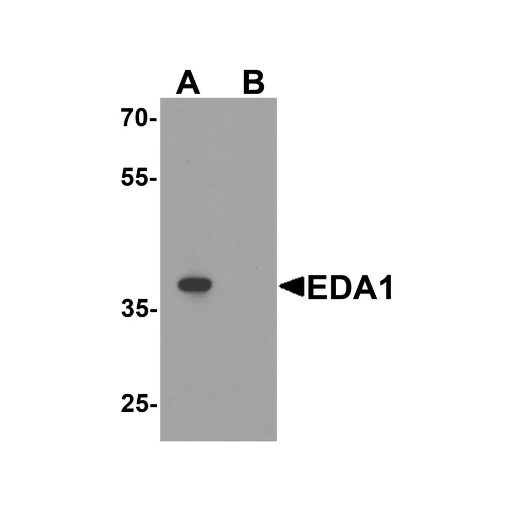 ProSci 8045_S EDA1 Antibody, ProSci, 0.02 mg/Unit Primary Image
