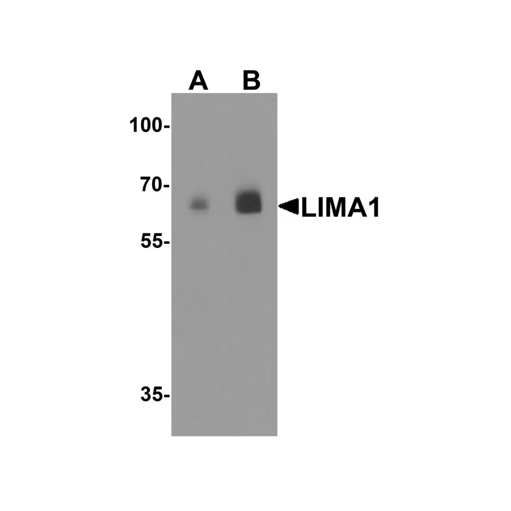 ProSci 8053 LIMA1 Antibody, ProSci, 0.1 mg/Unit Primary Image