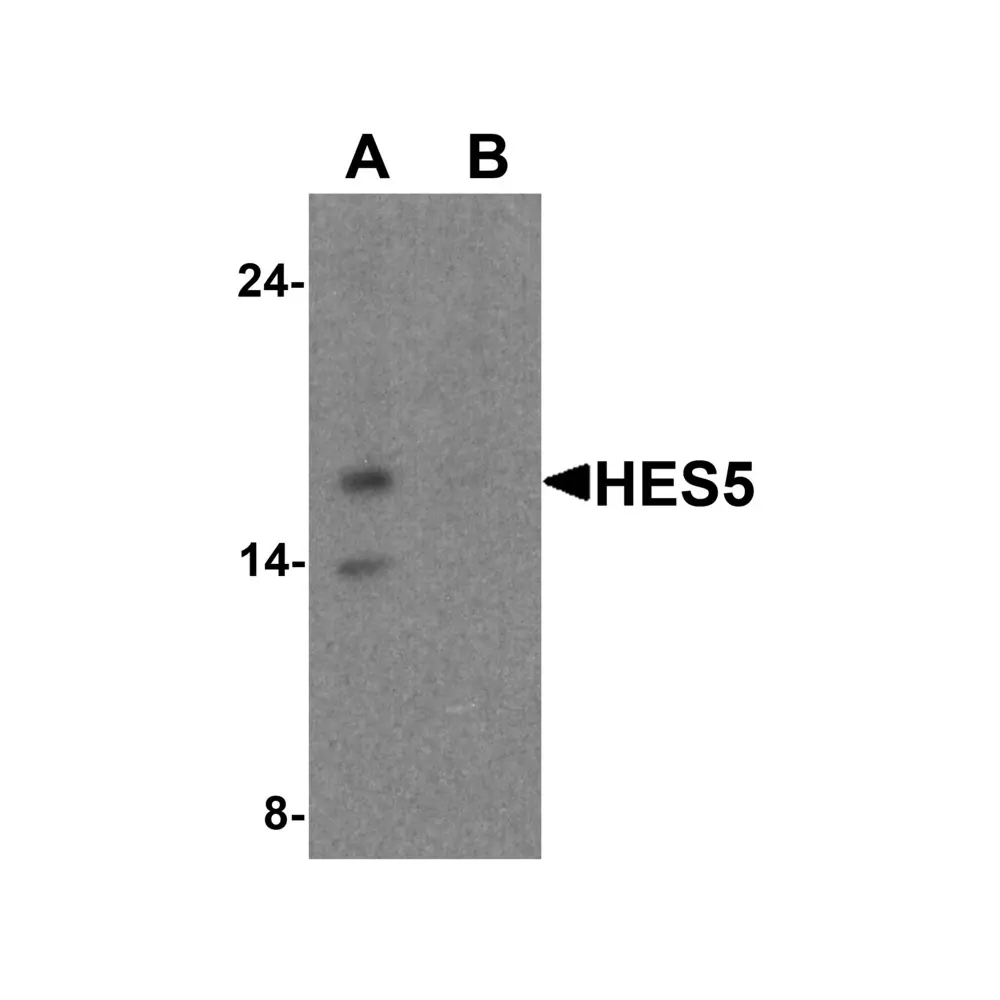 ProSci 8055 HES5 Antibody, ProSci, 0.1 mg/Unit Primary Image