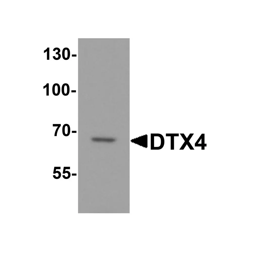 ProSci 8057_S DTX4 Antibody, ProSci, 0.02 mg/Unit Primary Image