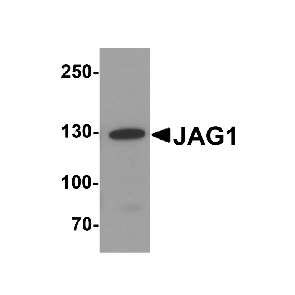 ProSci 8059 JAG1 Antibody, ProSci, 0.1 mg/Unit Primary Image