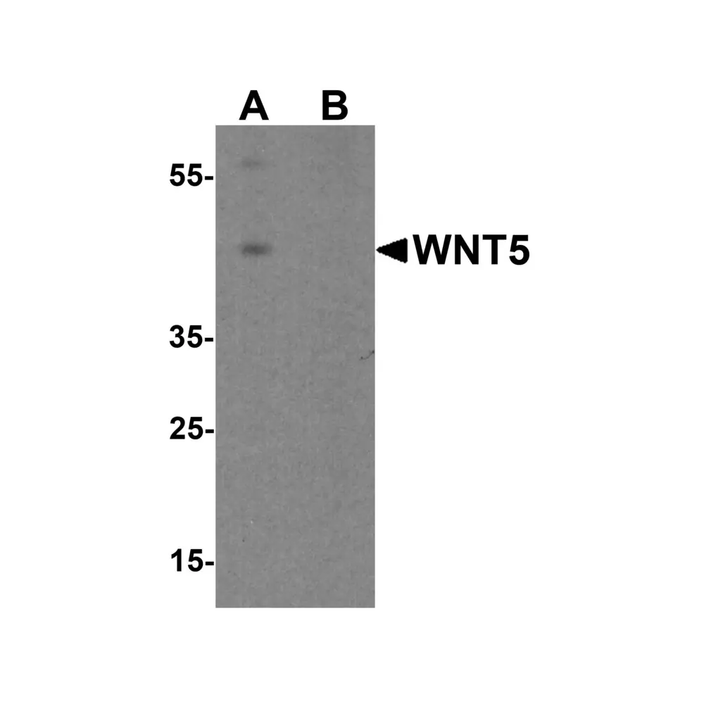 ProSci 8063 WNT5 Antibody, ProSci, 0.1 mg/Unit Primary Image